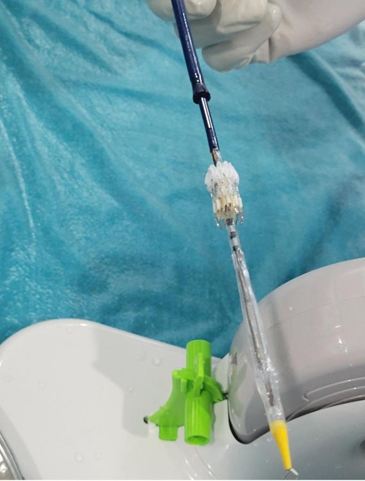 KIMS Becomes First Hospital in Odisha to Conduct TMVR to Repair Heart Valve : Ommtv